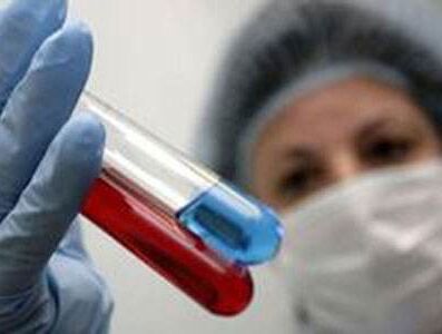 全自动91免费看视频软件网站有哪些检测方法？
